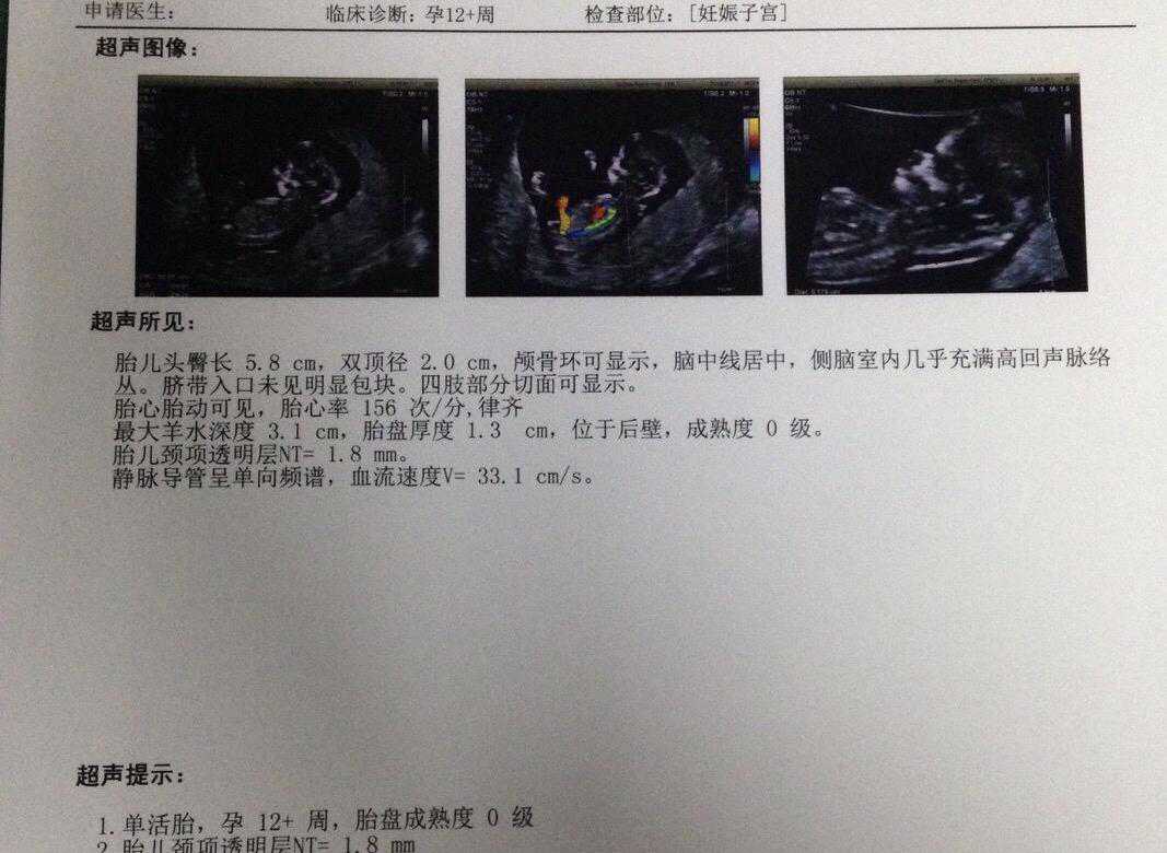 36岁为了二胎，不断的尝试做试管，终于诞下了