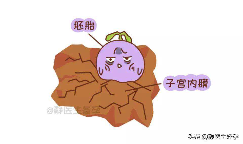 静医生备孕：要好孕就离不开内膜，注意这些细节好孕加分
